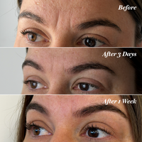 H2O+ Smoothy Anti-Wrinkle Patches